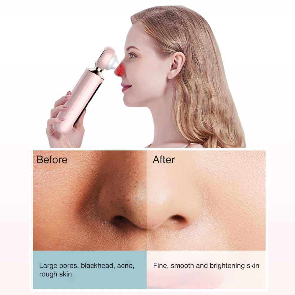 ɢʟᴏᴡᴀʀᴀ™ Blackhead Suction Machine