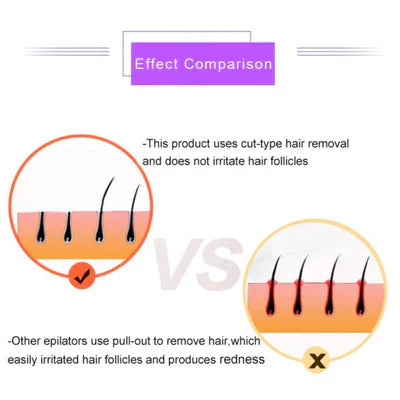 ɢʟᴏᴡᴀʀᴀ™Purple Epilator – آلة إزالة الشعر البنفسجية