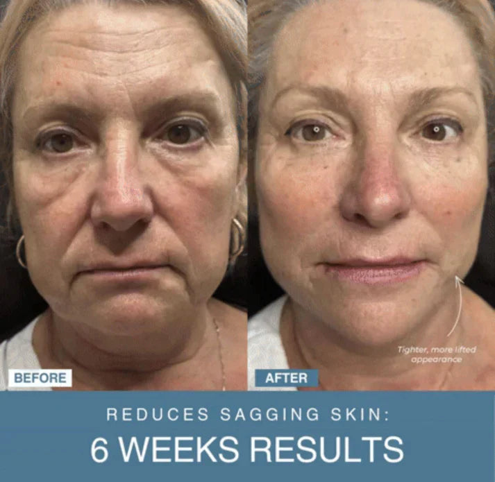 ɢʟᴏᴡᴀʀᴀ™ 7-in-1 LED Anti-Aging/Wrinkle Apparatus