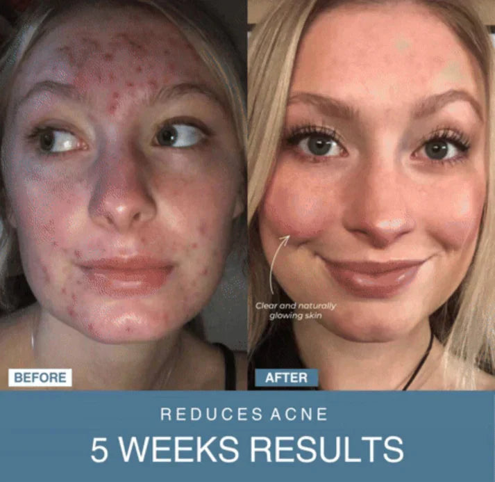 ɢʟᴏᴡᴀʀᴀ™ 7-in-1 LED Anti-Aging/Wrinkle Apparatus