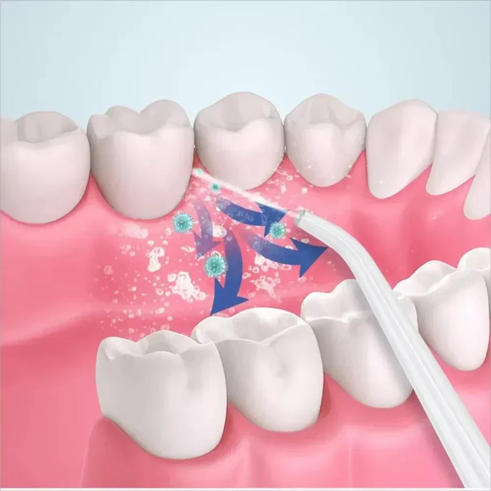 ɢʟᴏᴡᴀʀᴀ™3 In 1 Oral Irrigatorجهاز ري الفم 3 في 1
