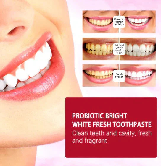 ɢʟᴏᴡᴀʀᴀ™Sp-4 Toothpaste