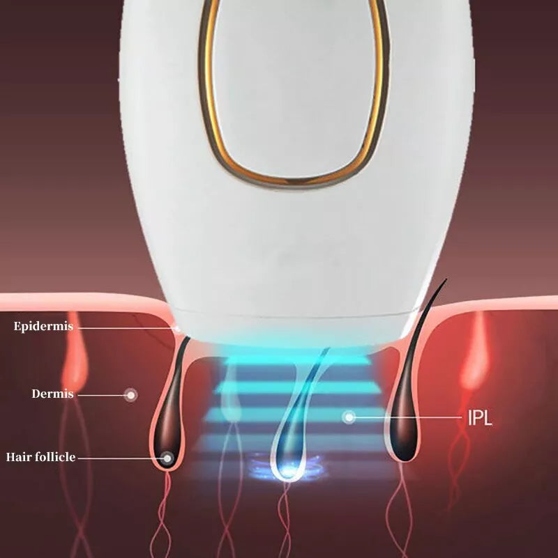 ɢʟᴏᴡᴀʀᴀ™ IPL Laser Hair Removal – جهاز إزالة الشعر بالليزر IPL